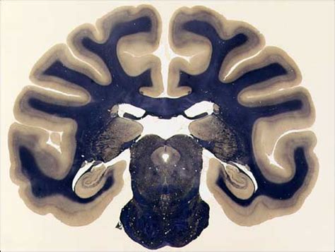 NeuroScience Associates | Weil Stain for Myelin