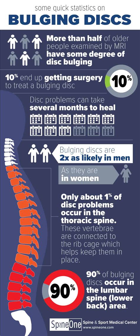 Bulging Disc Infographic - Statistics & Patterns - SpineOne