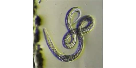 Nematodes: Classification, Structure, and Characteristics – Microscope ...