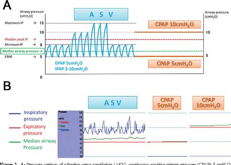 Figure 2 from Adaptive Servo-Ventilation Has More Favorable Acute ...