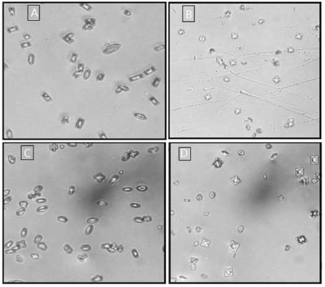 Calcium Oxalate incubation study. Representative photographs, under ...