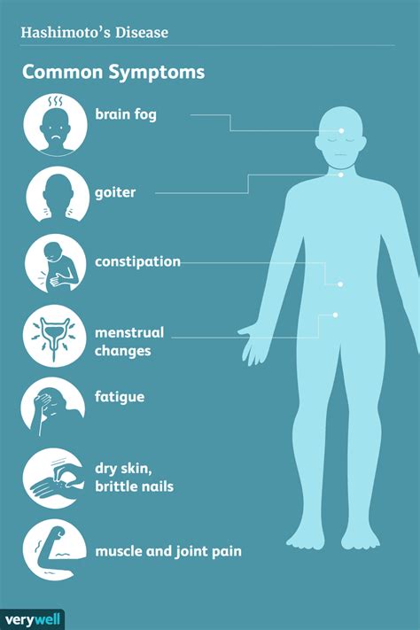 Hashimoto's Disease: Signs, Symptoms, and Complications