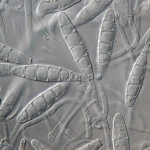 Microsporum - Species, Ecology, Infection and Treatment