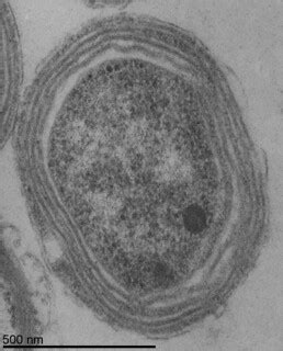 Prochlorococcus NATL2A TEM | Taken by Luke Thompson (Chishol… | Flickr