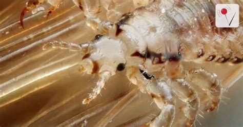 Super Lice Have Taken Over The U.S. | HuffPost Parents