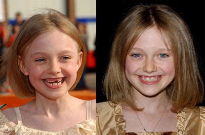 Save Dakota Fanning!: Dakota Fanning's Teeth