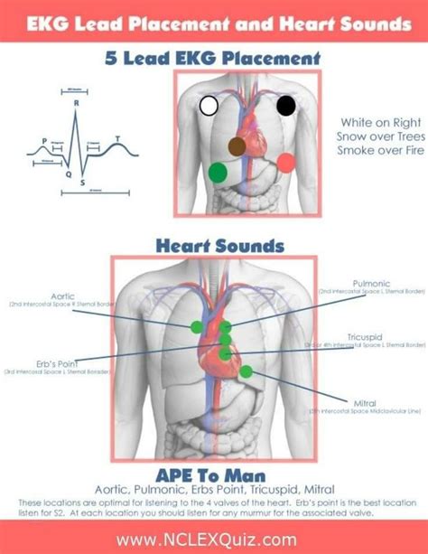 Pin by Celena Edwards on Nursing | Ekg placement, Ekg, Nursing pneumonics