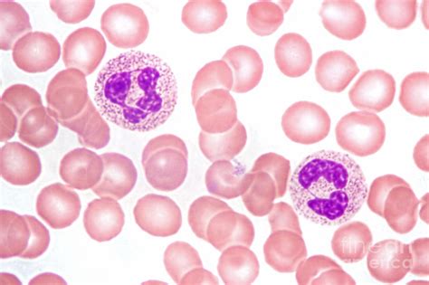 Neutrophils In Peripheral Blood Smear by M. I. Walker