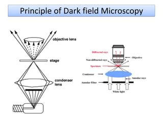 Dark field microscopy | PPT