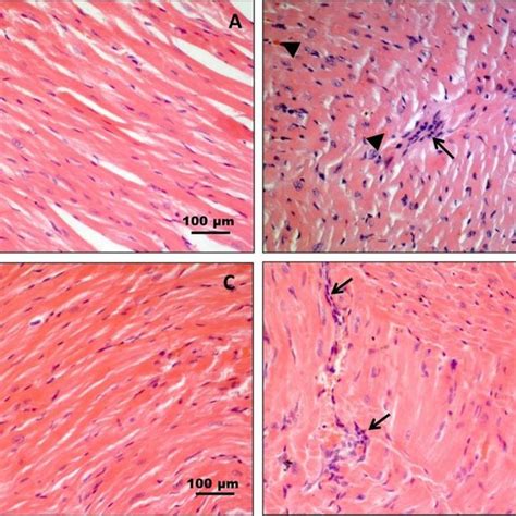 Histology of heart muscle tissue. Hematoxylin and Eosin staining. (A).... | Download Scientific ...