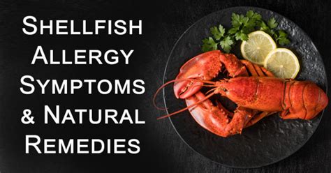 Common Shellfish Allergy Symptoms & Natural Remedies - David Avocado Wolfe