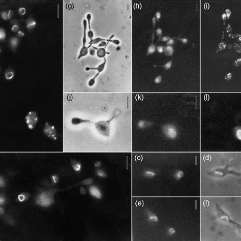 Fluorescent and phase-contrast microscopy of ‘ long-neck ’ yeast F ...