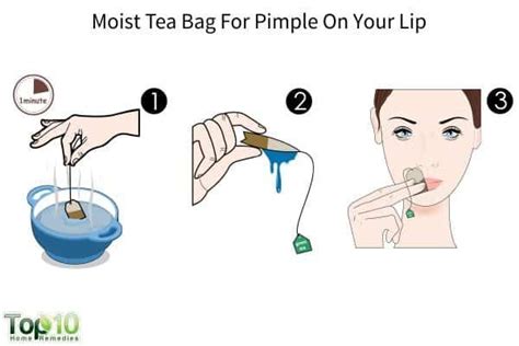 How to Get Rid of a Pimple on Your Lip - eMediHealth | How to line lips, Pimples, Pimples on lip ...