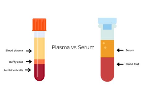 Plasma vs. Serum: Differences and Applications in Medical Research ...