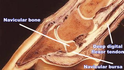 Navicular in horses: signs, causes and treatment | Horse & Hound