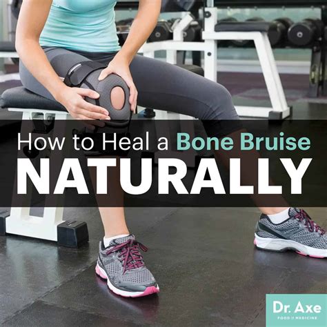 How to Heal a Bone Bruise Naturally - Dr. Axe