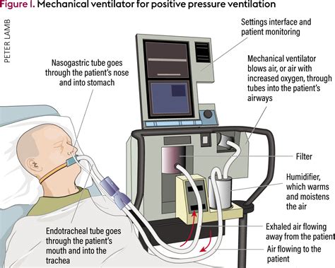 Nursing Standards Of Care For Ventilator Management - Basics in ...