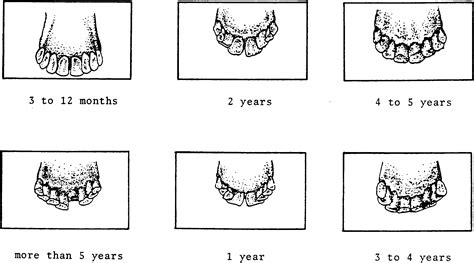 Sheep Teeth Age