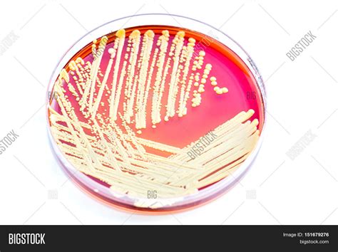 Micrococcus Luteus Image & Photo (Free Trial) | Bigstock