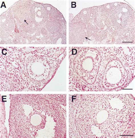 Detection of Apoptosis In situ labeling of apoptotic cells in the... | Download Scientific Diagram