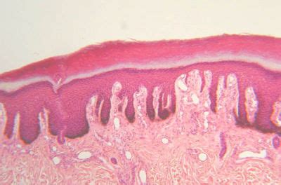 Integumentary System Histology - Skin - histology slide