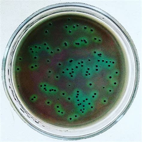 Salmonella typhimurium. Hektoen Enteric Agar. | Microbiology, Salmonella, Agar