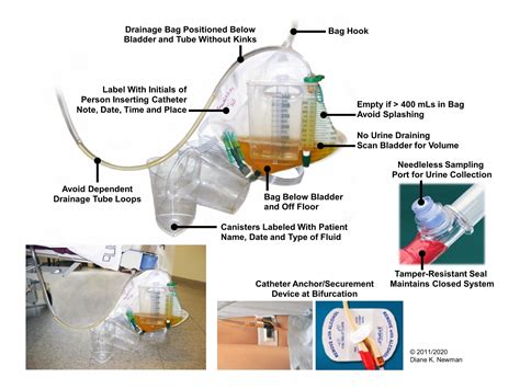 Prevention of Catheter-associated Urinary Tract Infections through ...