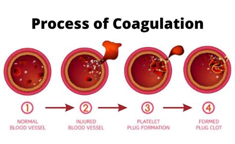 Unlocking the Mysteries of Medical Coagulation: Navigating the Intricate Dance of Blood