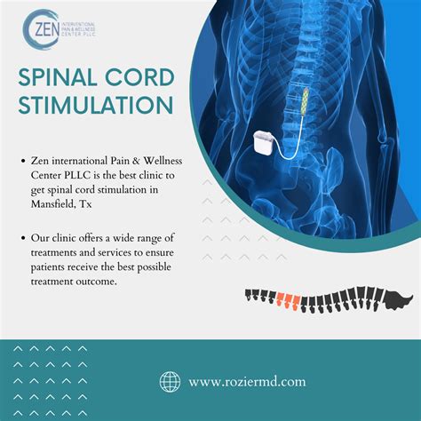 Benefits of Spinal Cord Stimulation: Patients Guide in Mansfield, Tx