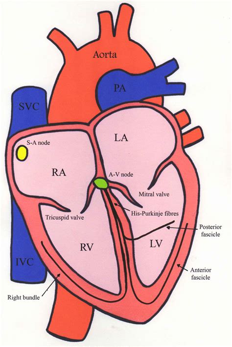 Atrial Fibrillation