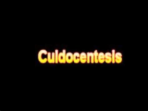 What Is The Definition Of Culdocentesis - Medical Dictionary Free Online - YouTube