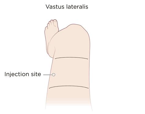 Intramuscular Injection: Definition and Patient Education