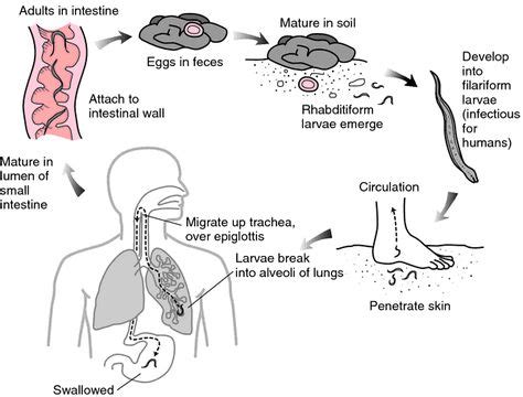 ancylostomiasis | Medical dictionary, Medical terms, Copd