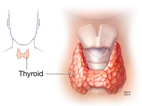 Thyroid nodules - Symptoms & causes - Mayo Clinic