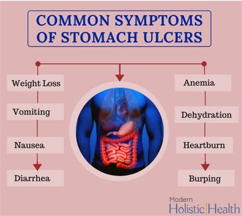 Best Natural Solutions for Stomach Ulcers | Modern Holistic Health