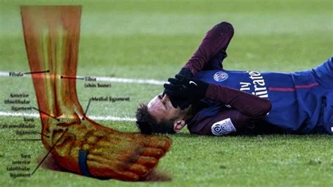 Neymar Jr ⚽ Injury + Marseille Shameful Defenders Hunting on Neymar ⚽ 2018 - YouTube