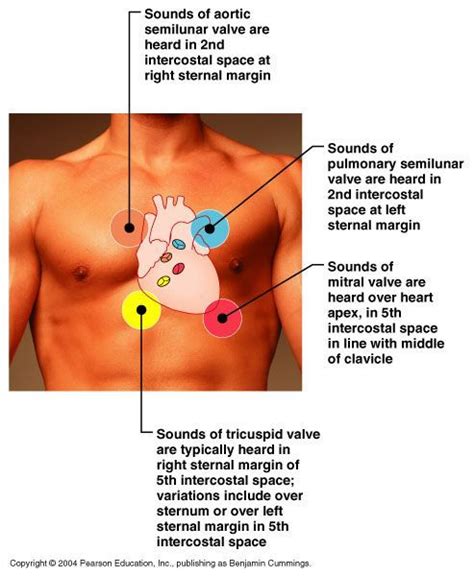 Placement of stethoscope for heart valves auscultation | Nursing tips ...