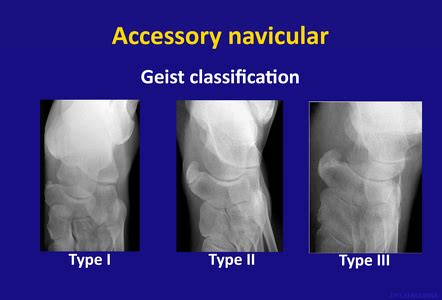 Playlist 'Diagnostic Imaging 1-Week 10 Lower Extremity' by Dr. Sandra ...