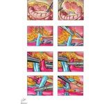 Simple and Radical Nephrectomy: Laparoscopic Radical Nephrectomy ...