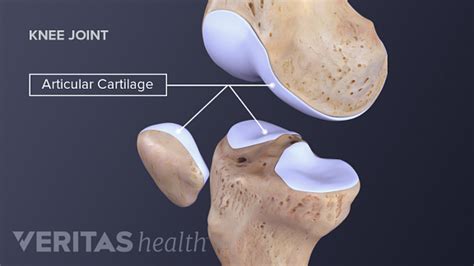 Knee Cartilage Repair, Regeneration, and Replacement