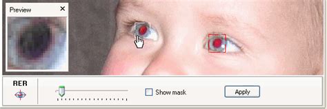 "Red eye" effect removal - SnapTouch Help