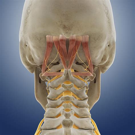 Suboccipital Muscles And Nerve, Artwork Photograph by Science Photo Library