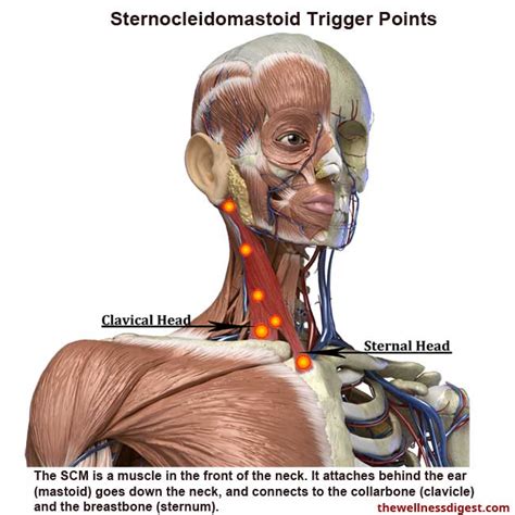 Sternocleidomastoid Muscle Pain