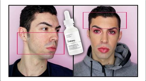 The Ordinary Hyaluronic Acid UPDATE (5 MONTHS) - YouTube