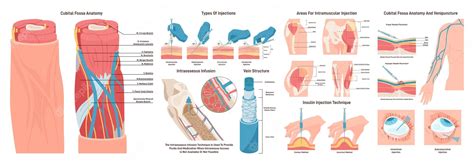 Premium Vector | Injection sites set Medicine injection sites on the human body