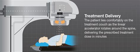 How Does Spine Radiation Therapy Work? - Brainlab.org