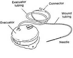 Hemovac Drain Placement - Best Drain Photos Primagem.Org