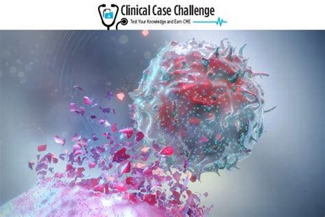 PRIME® Clinical Case Study - Clinical Case Challenge: Evidence-based Treatment Sequencing for ...