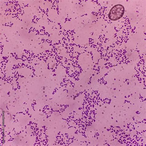 Enterococcus Gram Stain