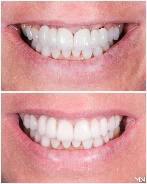 Cosmetic Dentistry Before and After Photos | Helm Nejad Stanley